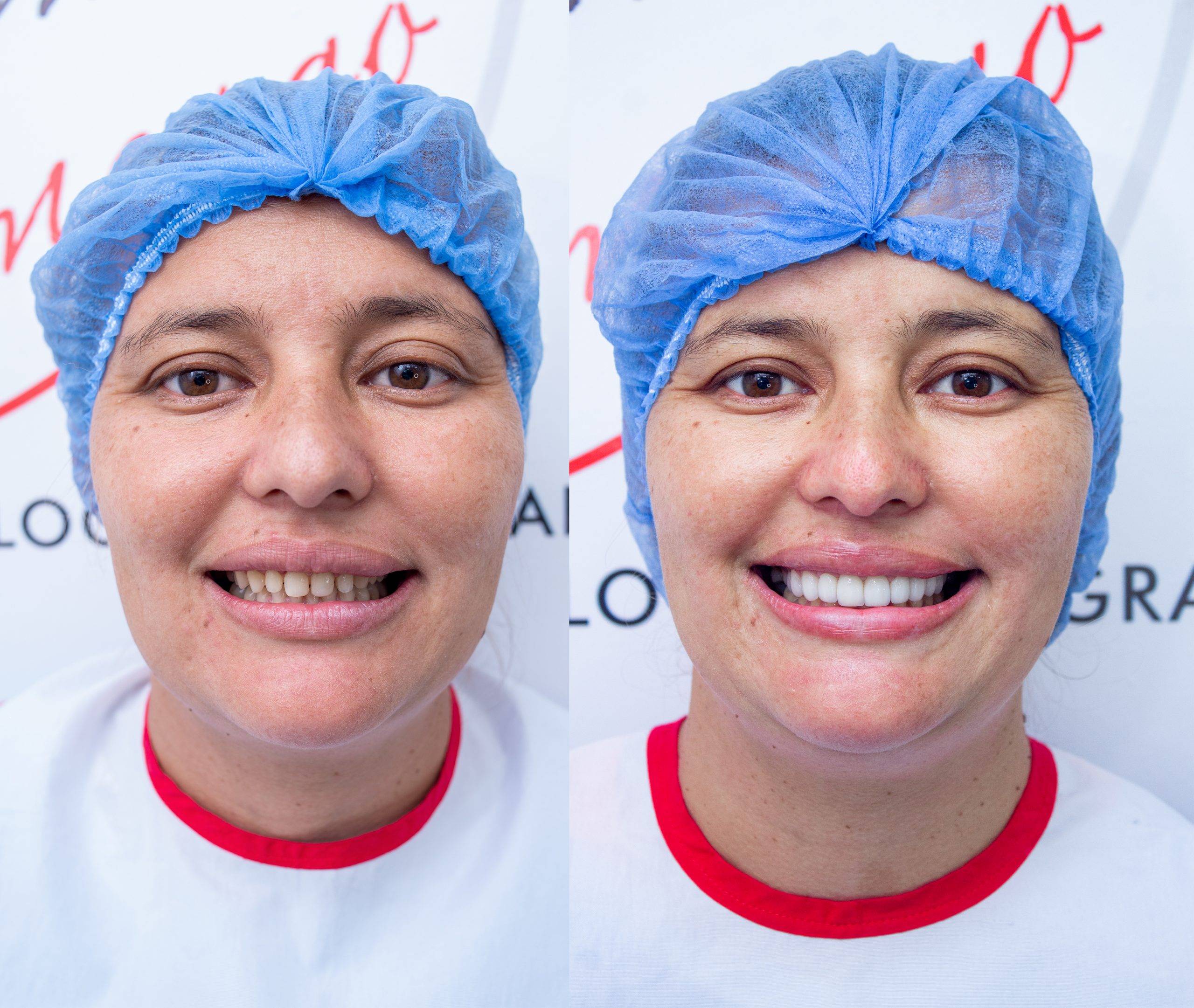Rehabilitación oral en Barranquilla